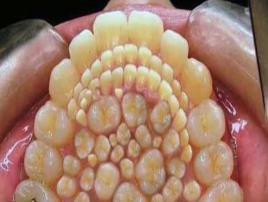 1693888750_too-many-teeth_mmthumb.jpg