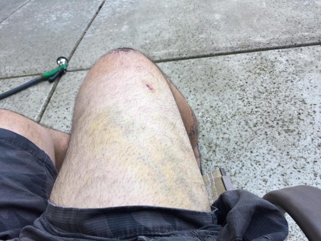 accident 2.jpg