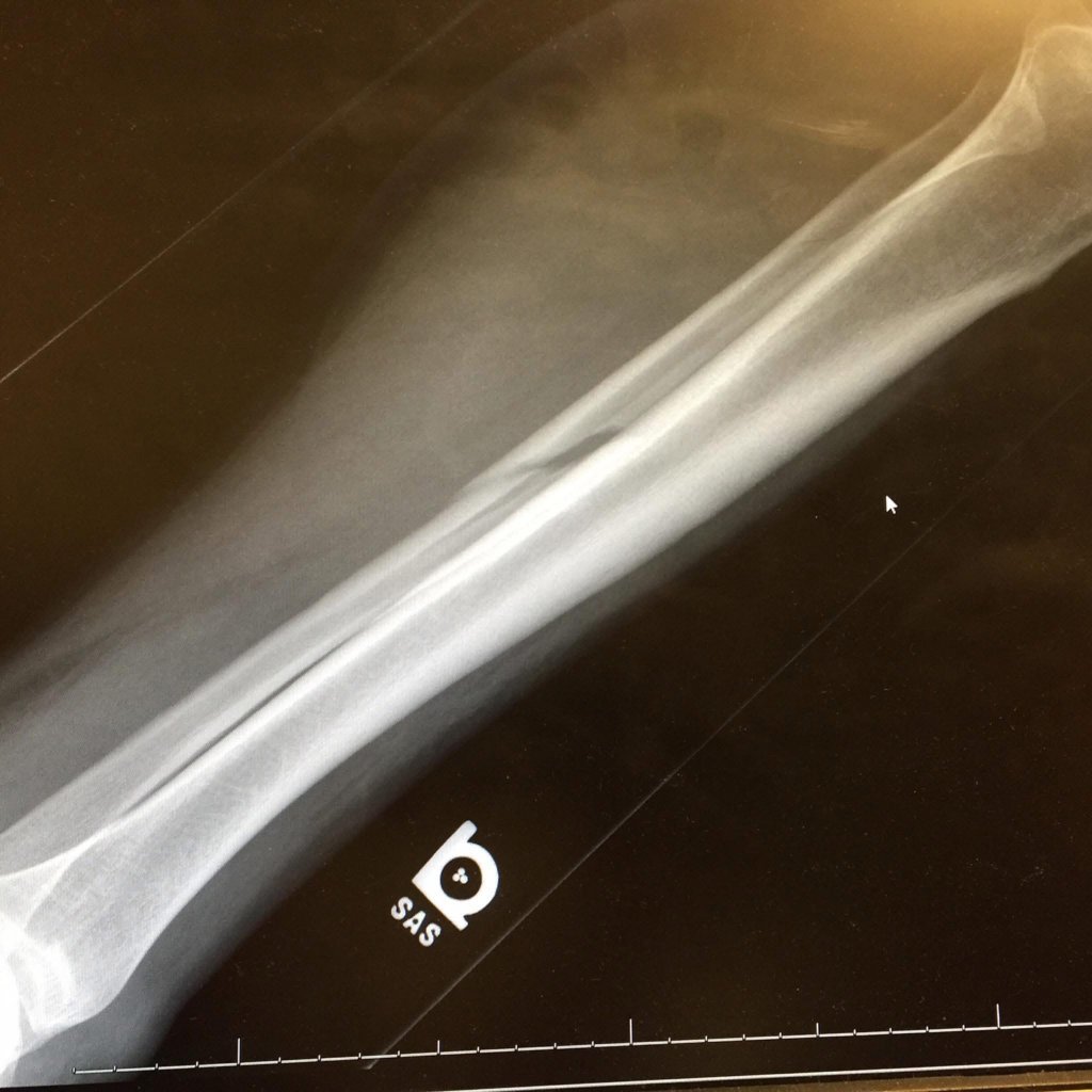 accident 5.jpg