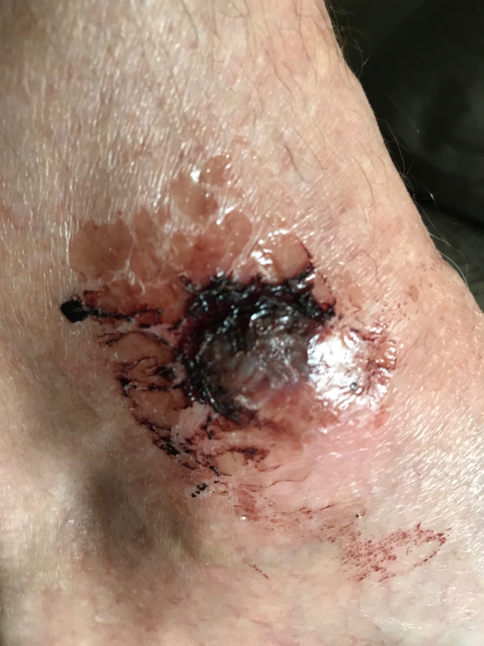 ankle5.jpg
