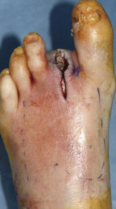 foot.jpg