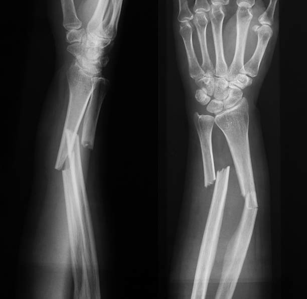istockphoto-471457370-612x612.jpg