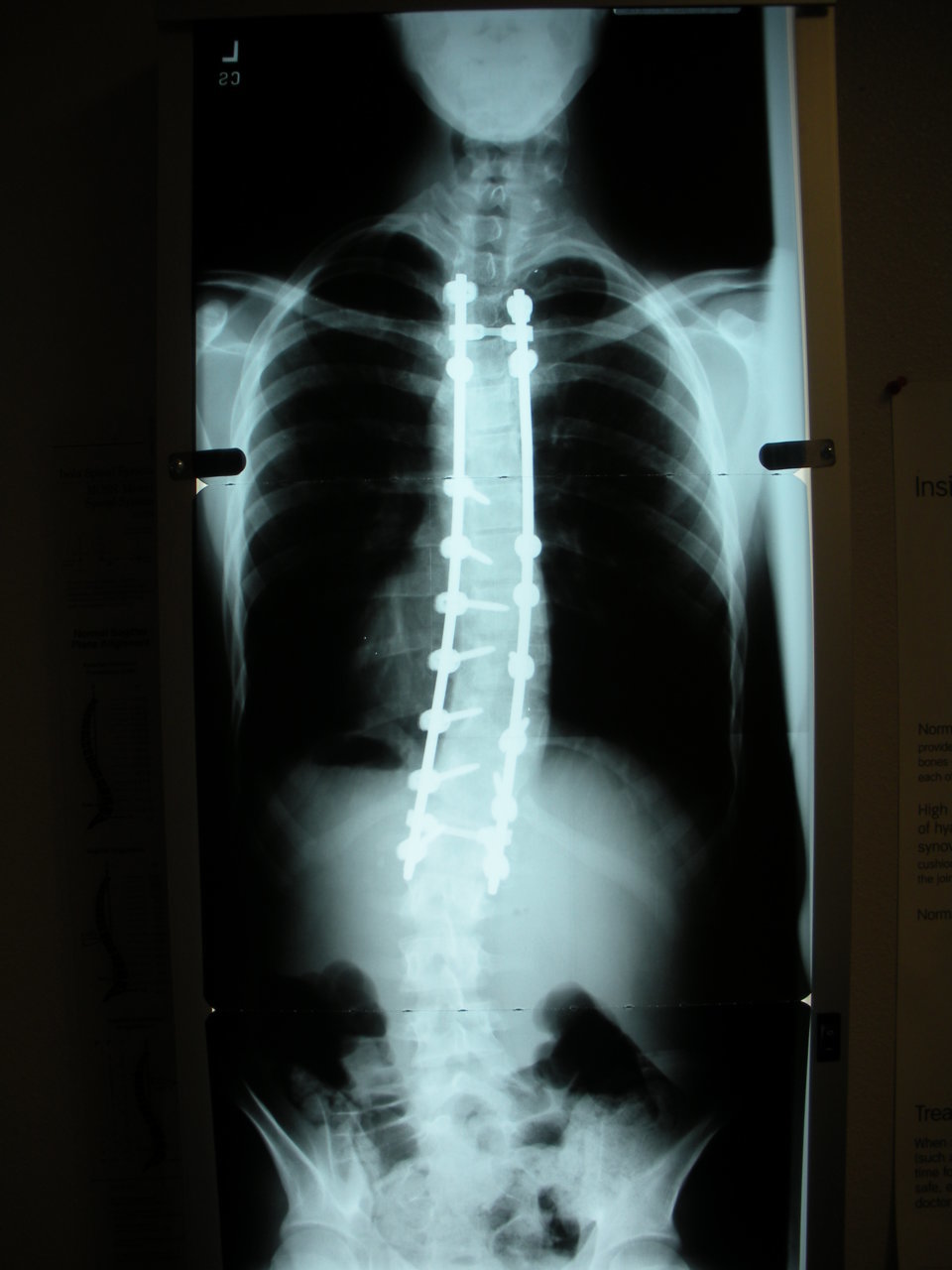 New Back 02-20150510-100756640.jpg