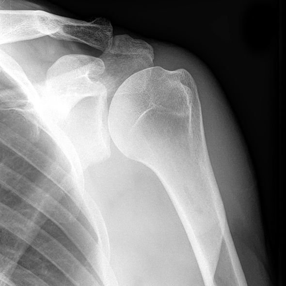 NORMAL-SHOULDER-7-1574035705_6c5b139a3b574a9c95c56122acc3ac8177fe907f.jpg