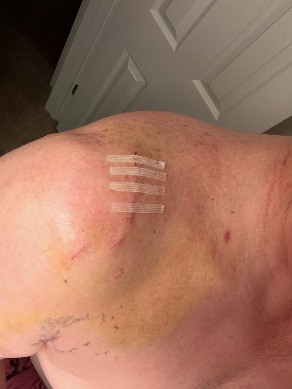 Shoulder.jpg