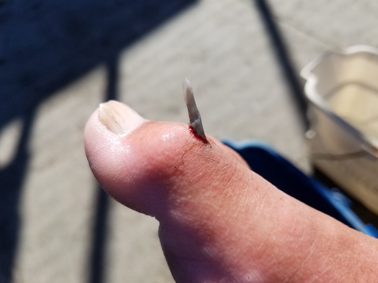 Toe1.jpg