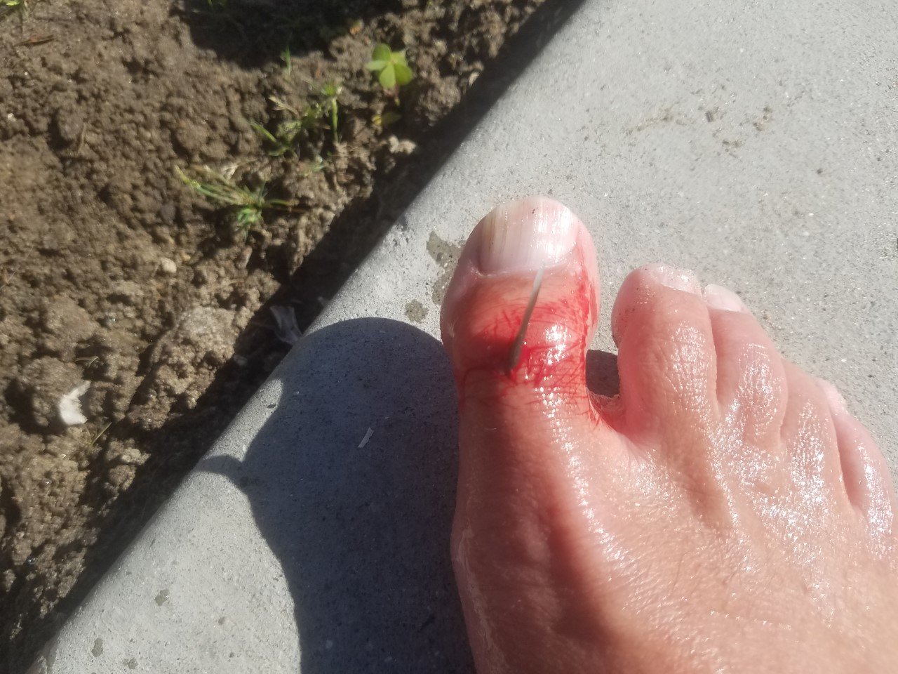 Toe2.jpg