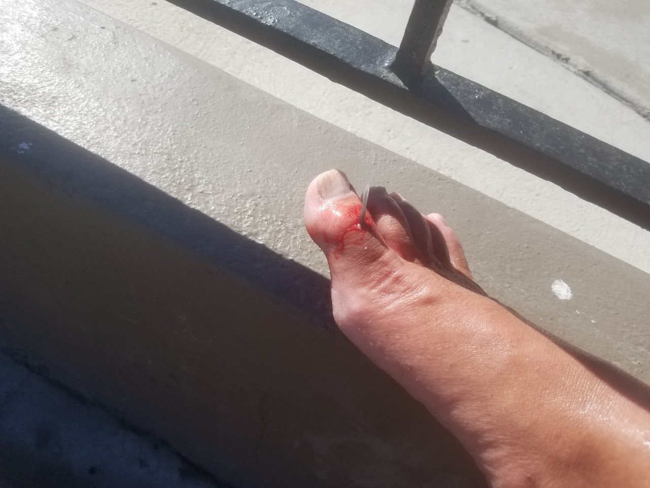 Toe3.jpg