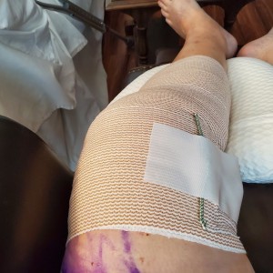 Knee